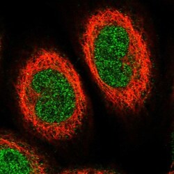 ETV7 Antibody, Novus Biologicals:Antibodies:Primary Antibodies